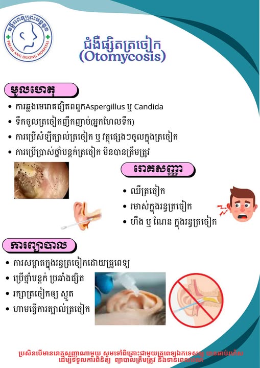 ជំងឺផ្សិតត្រចៀក (Otomycosis)